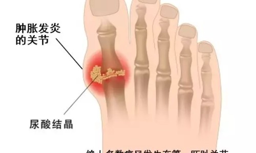 高龄产妇睡眠不好网 - 为你提供高龄产妇如何保养、产妇睡眠不好怎样调理